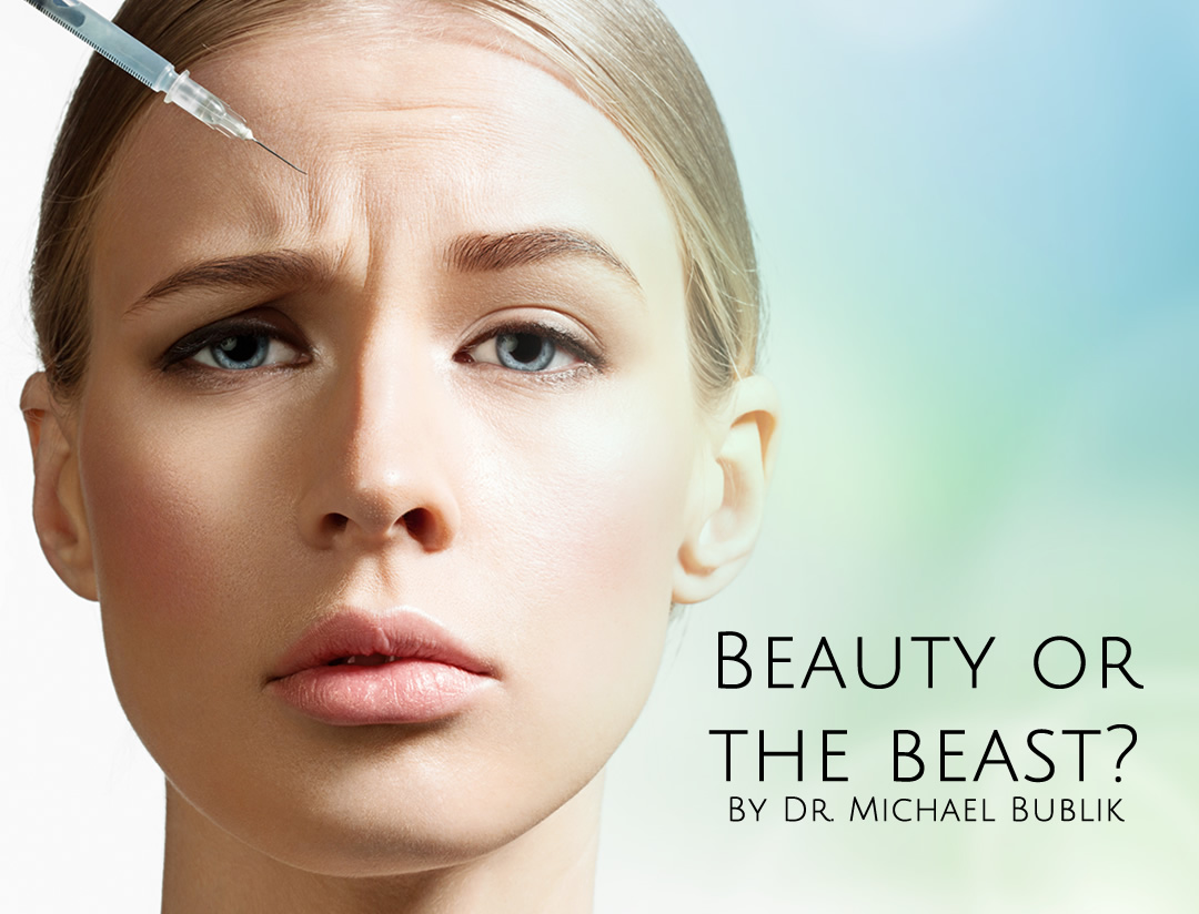 post-beauty-or-the-beast